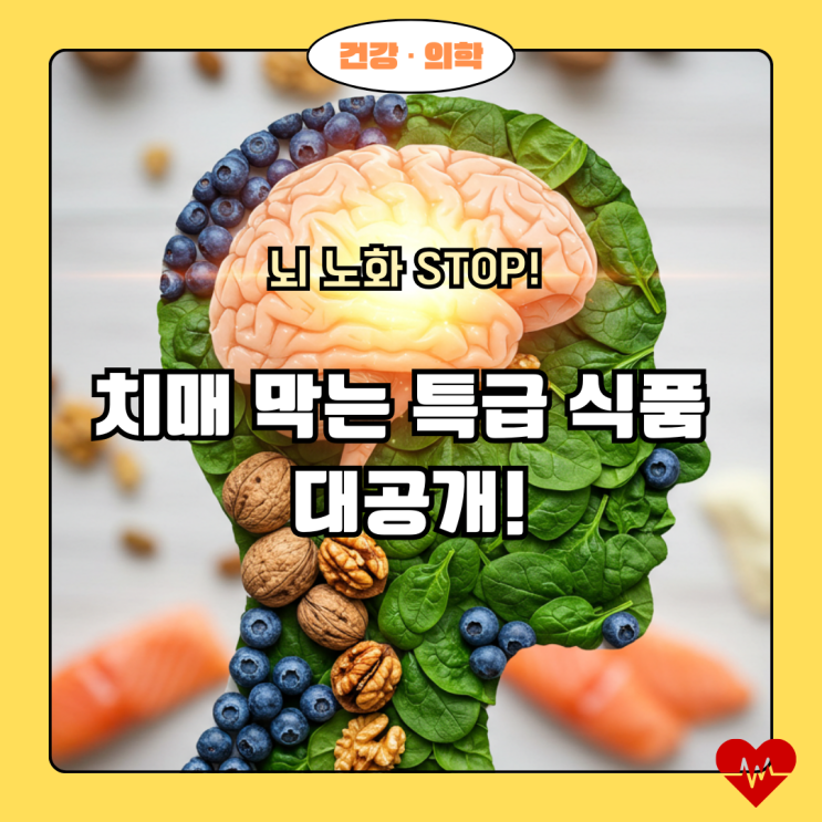  내 머릿속의 지우개, 치매가 두렵다면? 뇌를 젊게 만드는 기적의 슈퍼푸드 총정리!