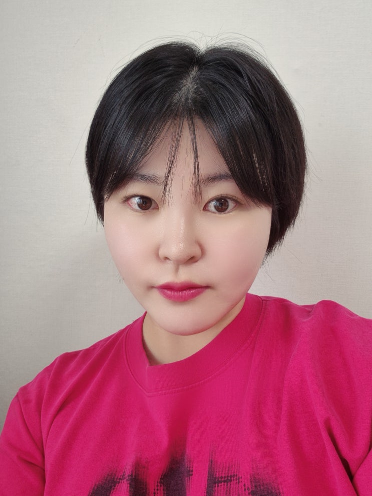  춘천 온의동성형외과 리쥬란힐러 2cc 인젝터 + 리쥬란부스터 내돈내산 후기