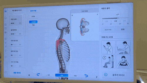  [인천리프팅] 체형교정 잘하는 스페이스뷰티 인천루원시티점