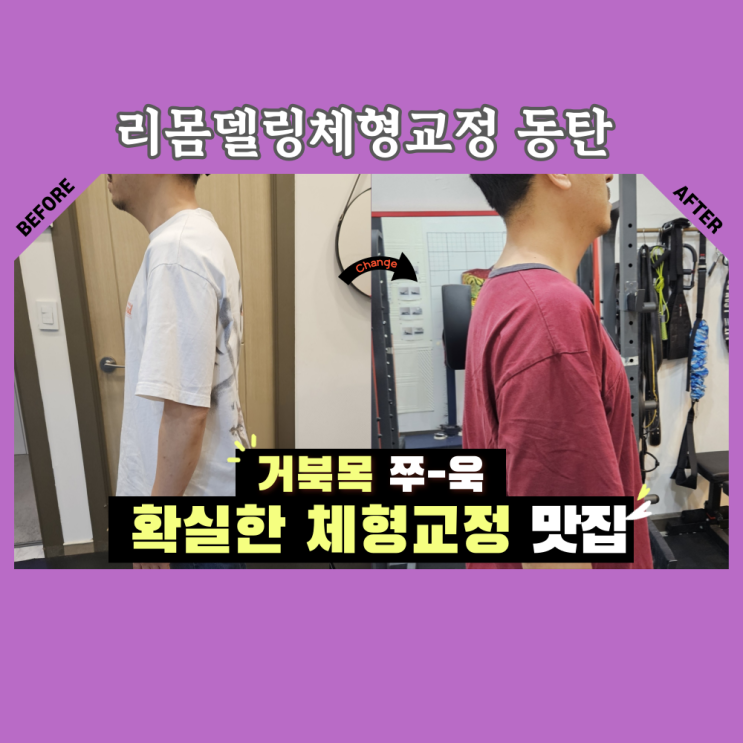 동탄 체형교정, 리몸델링 40대 거북목 아저씨의 리얼후기 동탄 체형교정, 리몸델링 40대 거북목 아저씨의 리얼후기