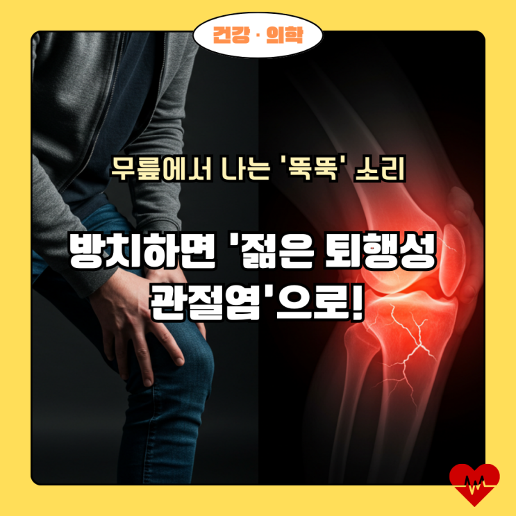  무릎에서 '뚝뚝' 소리가? 연골연화증, 젊다고 방심하면 큰일 나는 이유!