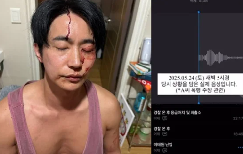 <b>전호준</b> 전여친 <b>폭행 논란</b>, 피투성이 사진과 녹취록 공개 (ft.... 