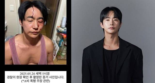  “폭행하고 성병 옮겼다”vs피투성이 얼굴…뮤지컬배우 전호준 폭로전