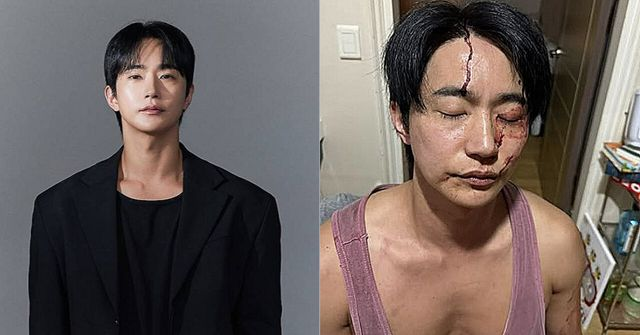  전호준 전 연인 “결혼 빙자·폭행 피해”…전호준 “사실 아냐” 정면 반박