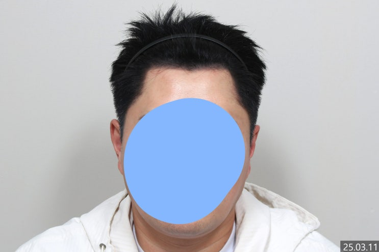  강남두피문신 잘하는곳 찾는다면? (유지기간, 가격, 리터치, 후기)