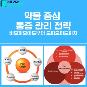 통증의 치료 진통제 약물 비오피오이드와 옥비오이드란?!