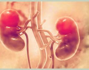 신장/비뇨기계 질환 네번째 신장암Renal Cell Carcinoma 에 대해