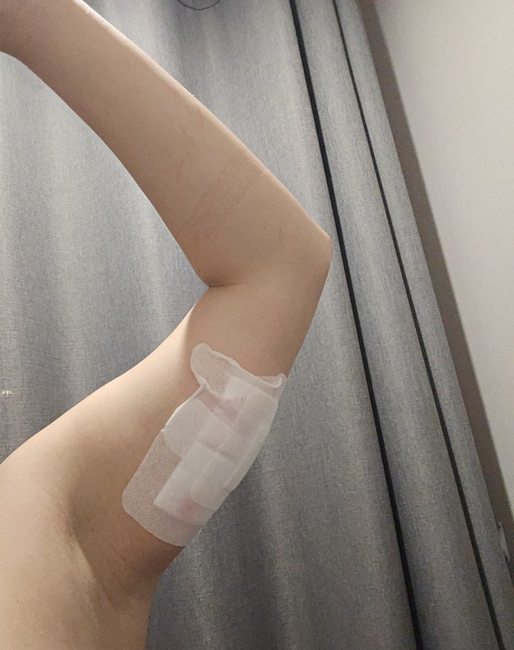  서울 다이어트병원 팔뚝 지방분해주사 용량 변화 기록
