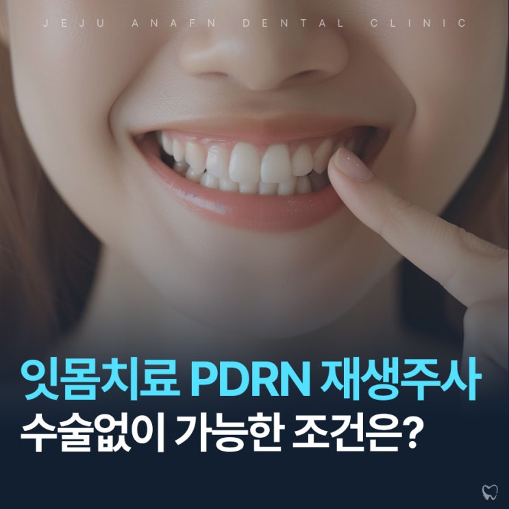  제주도잇몸치료 재생주사 pdrn으로 수술없이 가능한 조건은