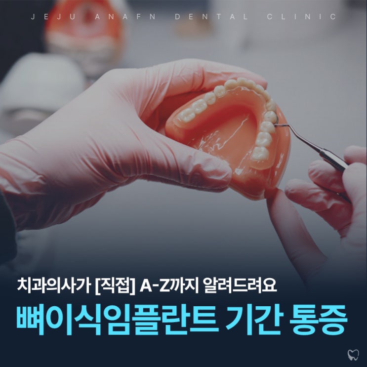 제주치과 뼈이식임플란트 통증과 기간이 궁금하다면