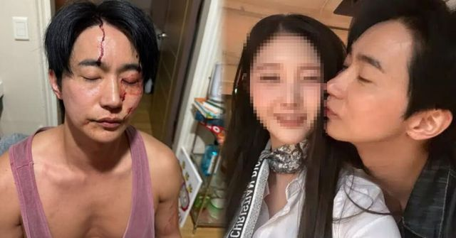  '전여친 폭행·성병' 뮤지컬 배우 전호준 누구? 피투성이 얼굴·녹음 파일 공개 (+ 인스타, 나이)