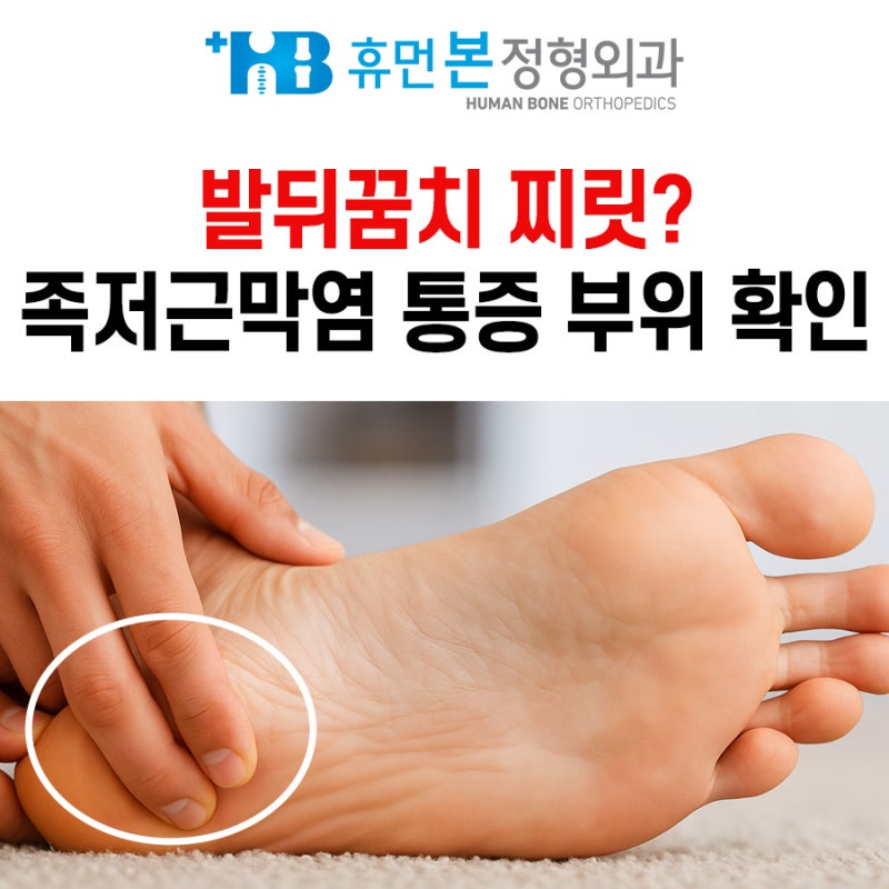 족저근막염 통증 부위 족부병원 인천
