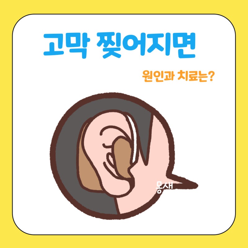 고막이 찢어지면 어떻게 하나요? 고막 파열 원인과 증상 치료는?