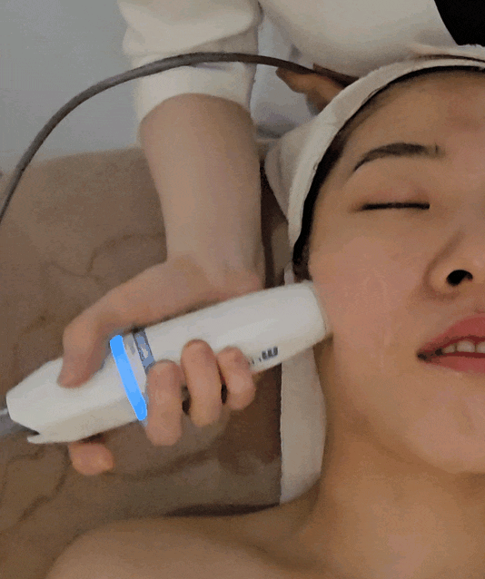  광주 피부관리 더맑은스킨 신창점 하이푸리프팅 후기