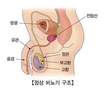 음경 발기지속증(Priapism)