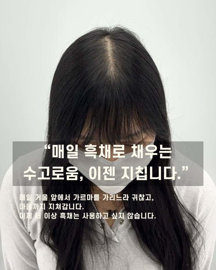  대전두피문신, 자신감이 필요할 때
