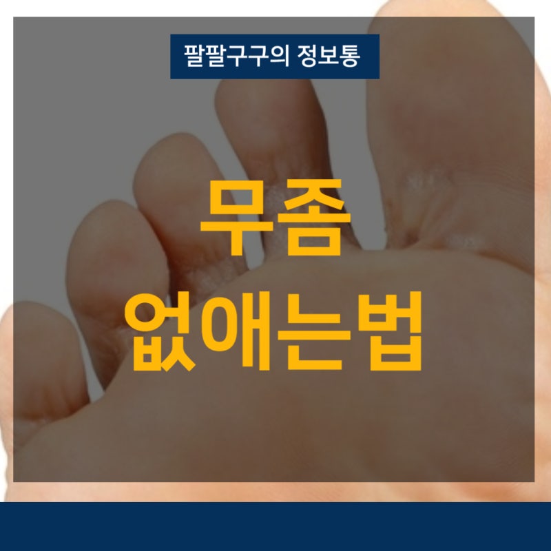 무좀 없애는법 재발 막기 위한 생활 속 실천법까지