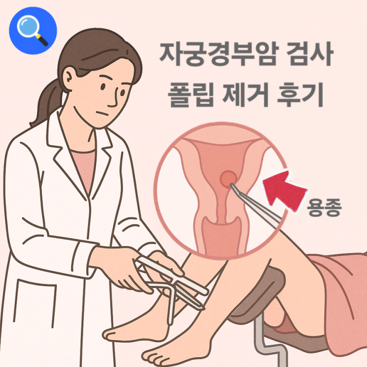  자궁경부암 검진 폴립제거 초음파 보험실비