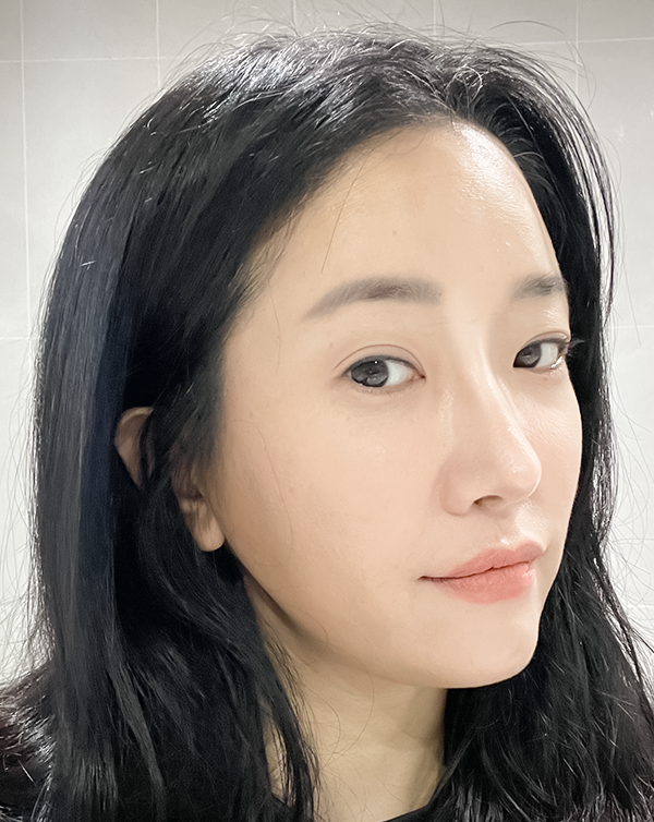  역삼동피부과 PRP주사 추천! M샤인주사EX 가격 및 솔직 후기