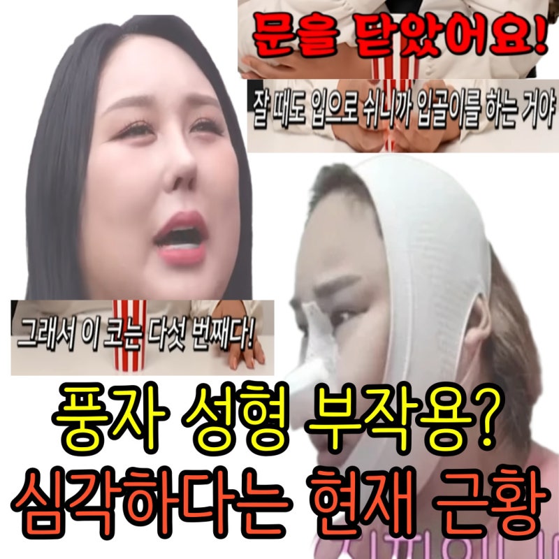 풍자 코 성형 5회, 눈 수술 4회 했다고? 부작용 심각하다는 현재 근황