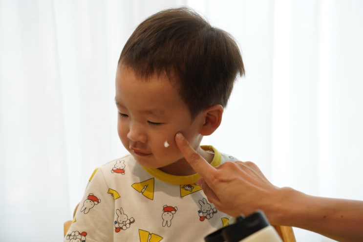  아기아토피로션 시도 때도 없는 긁음 멈춘 비결
