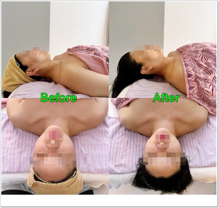  부산 중구 남포동웨딩케어 주말예약도 가능한 작은얼굴 윤곽테라피 남포동피부관리  : 라프로메사