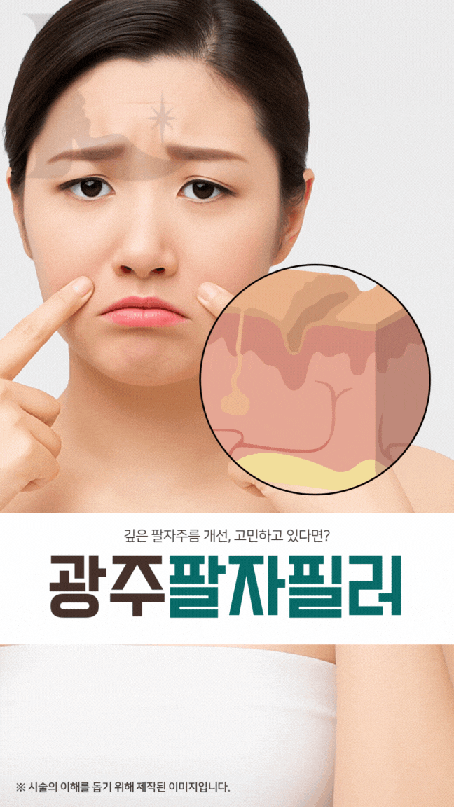  광주팔자필러 깊은 주름 개선되지 않는다면 리프팅 잘하는곳도 찾아야