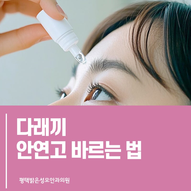 다래끼 안연고 바르는 법