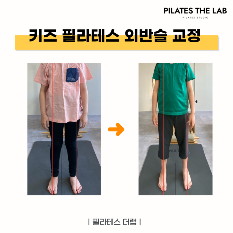  목동 필라테스 키즈 외반슬(X다리) 필라테스 교정 운동