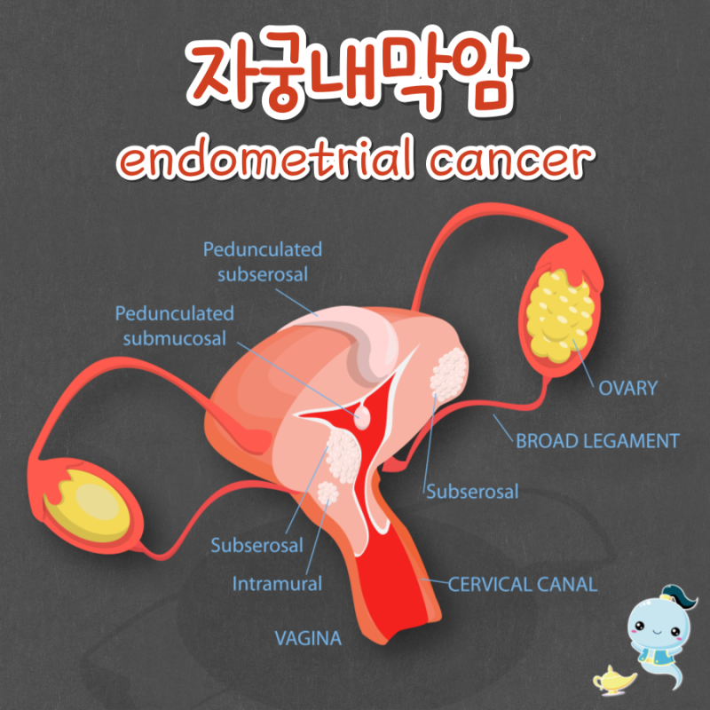 자궁내막증 자궁내막암 자궁내막제자리암 같은거 아닌가요?