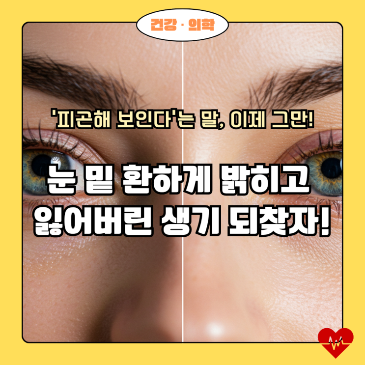  "시간의 흔적을 지우고, 다시 빛나는 눈가: 눈 밑 꺼짐, 당신의 젊음을 깨워줄 솔루션"