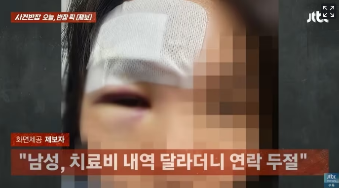 20 바벨에 맞아 '뇌진탕'…"보험사 '헬스장 과실 없다' 발뺌" 20 바벨에 맞아 '뇌진탕'…"보험사 '헬스장 과실 없다' 발뺌"