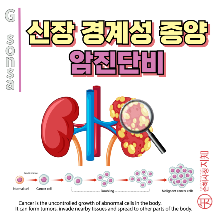  신장 경계성 종양 - 보험 가입 시기에 따라 암진단비 100% 가능? - [보험금, BA+DA]