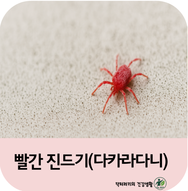 빨간 진드기 다카라다니 퇴치법 예방법 총정리