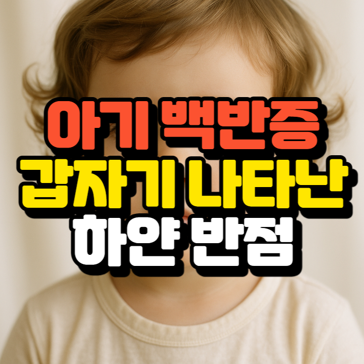 피부에 하얀 반점, 아기 백반증일 수 있습니다