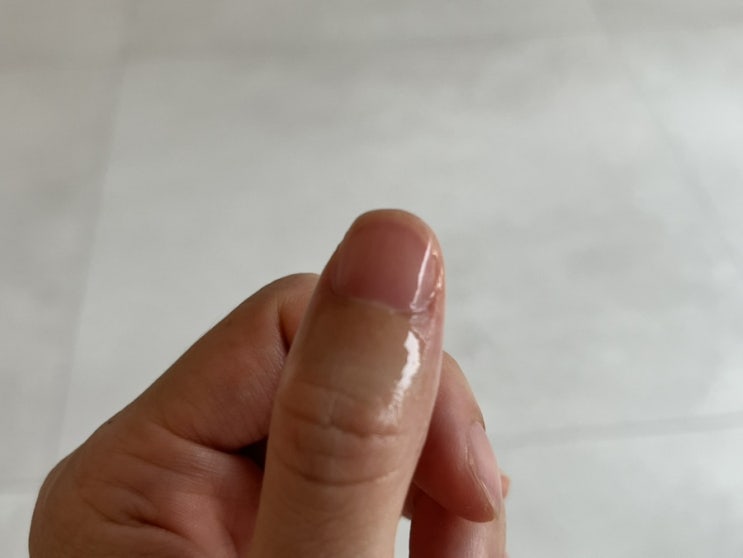  패디쉴드 키토아몬드 손발톱 재생앰플 솔직 후기