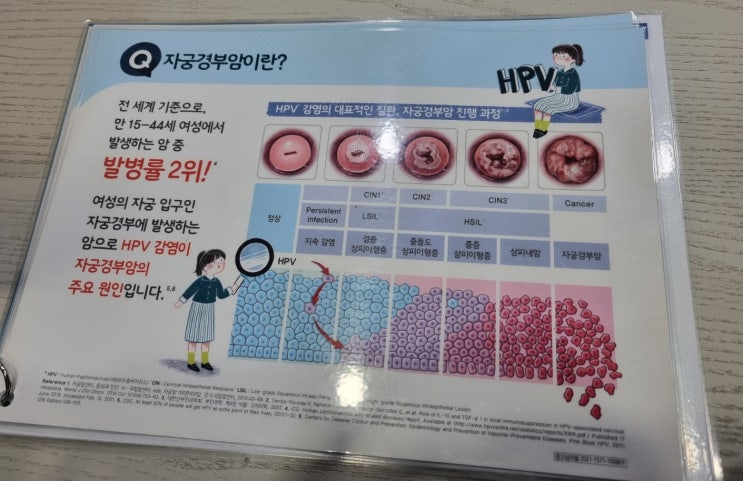  자궁경부암 검사 종류 세포검사, hpv바이러스, 확대촬영