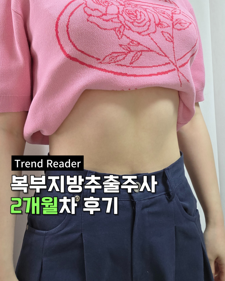 복부 지방추출주사 후기 2개월 비포애프터 -9cm감소