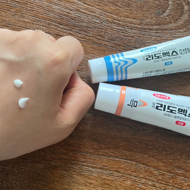 리도맥스 연고 0.15 0.3 비교 아기 얼굴 약국 처방 가격 효능 땀띠 가려움 스테로이드