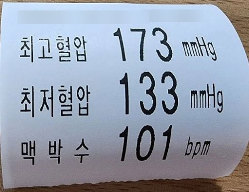  알티지 오메가3 섭취시간 효능 정리
