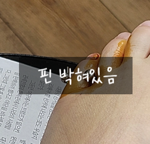 새끼발가락 골절 수술 비용(입원, 치료, 검사비 포함)