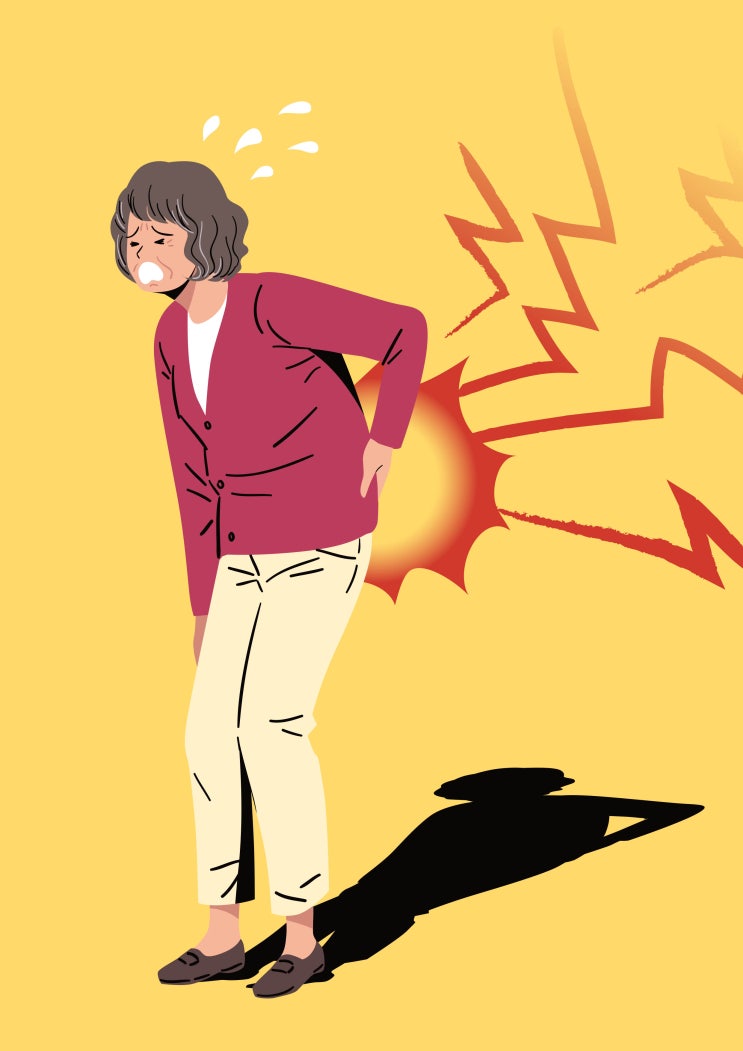  낙상 후 허리 통증/척추압박골절의 치료 시멘트시술(의사작성)