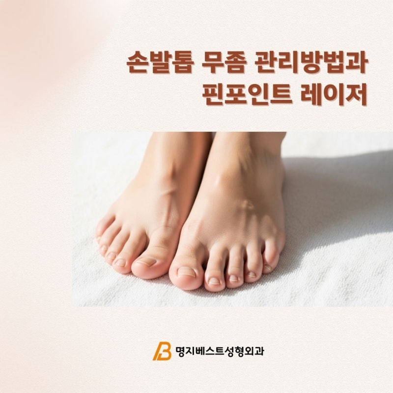 부산피부과 명지 손발톱 무좀 증상 및 관리 방법과 핀포인트 레이저