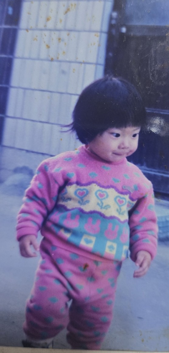  옆광대축소 고민돼 광대보톡스 옆광대주사 해봤어요~ 내돈내산 후기