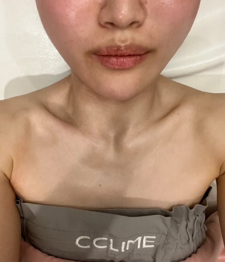  강남구청에스테틱 크레이지대칭 끌리메 후기