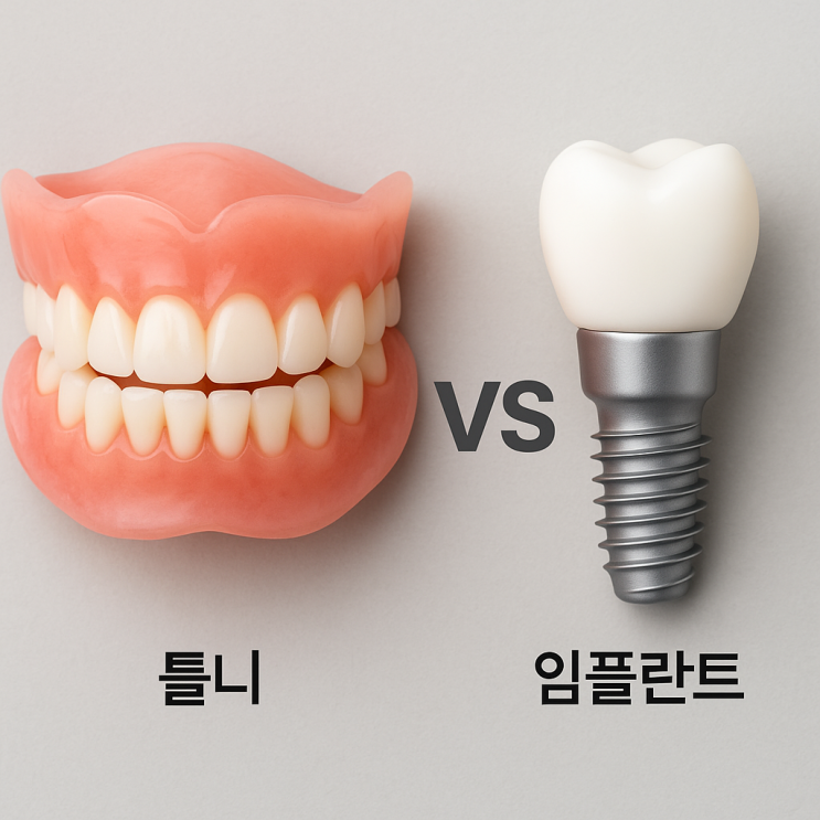 임플란트와 틀니, 어떤 치료가 나에게 맞을까?