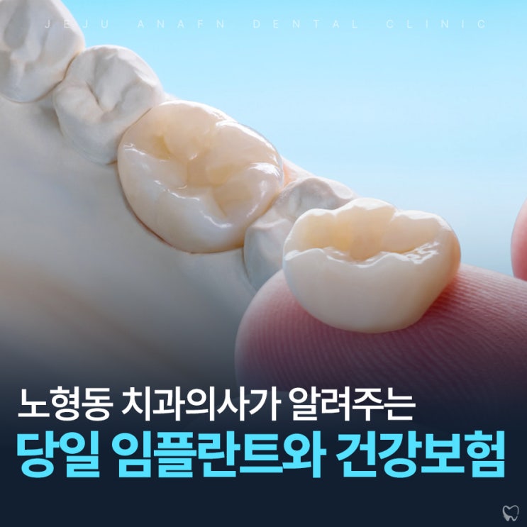  노형동치과 당일 원데이 임플란트와 건강보험혜택까지
