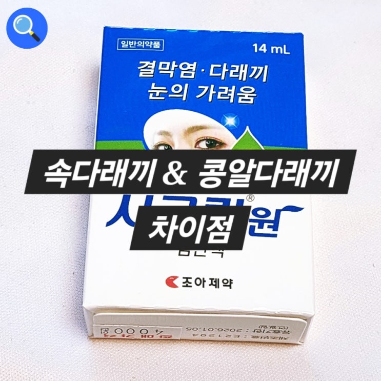  속다래끼 콩알다래끼 안약 사용 후기 (셀프압출 실패)