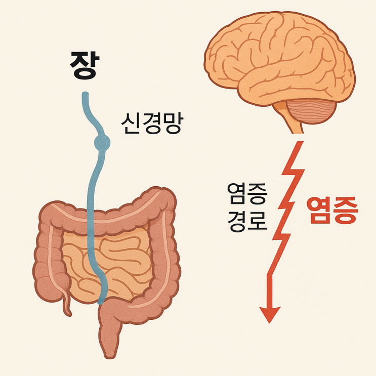  짠 음식, 뇌종양까지 부른다고요? 장내 미생물의 반란