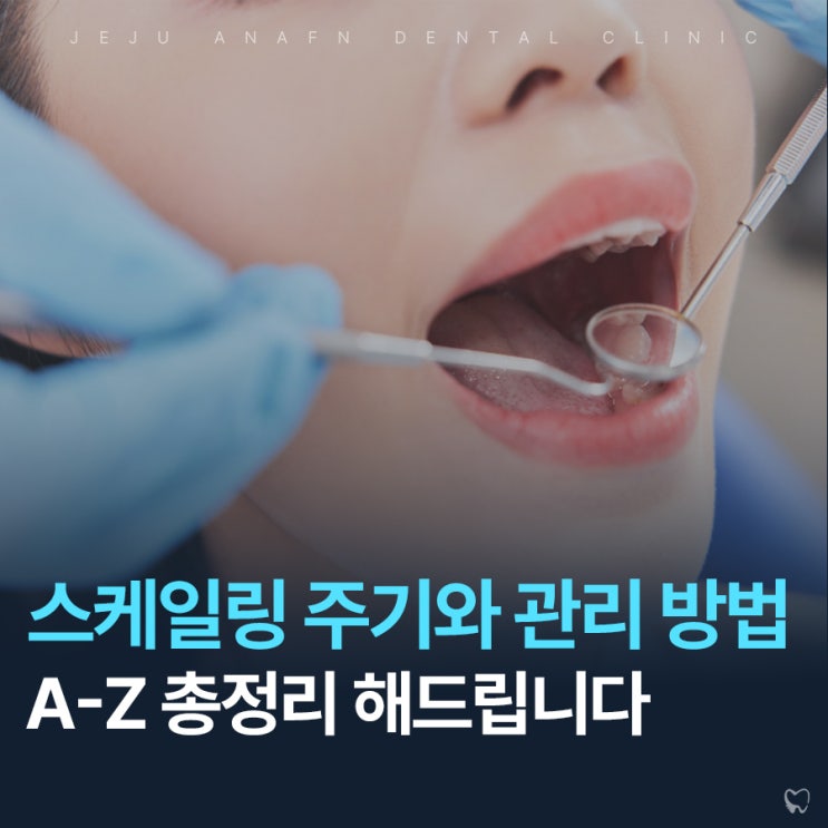  제주도치과 스케일링 주기와 시술 후 관리방법 총정리